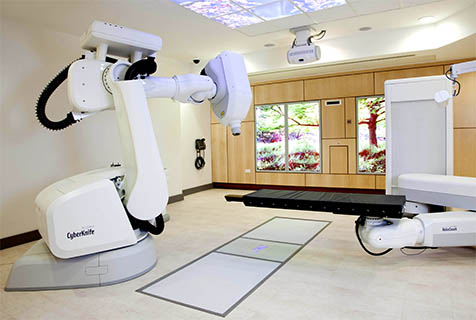 Cyberknife